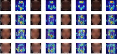 Progressive Multi-Scale Vision Transformer for Facial Action Unit Detection